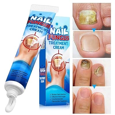 NAIL FUNGUS TREATMENT CREAM
